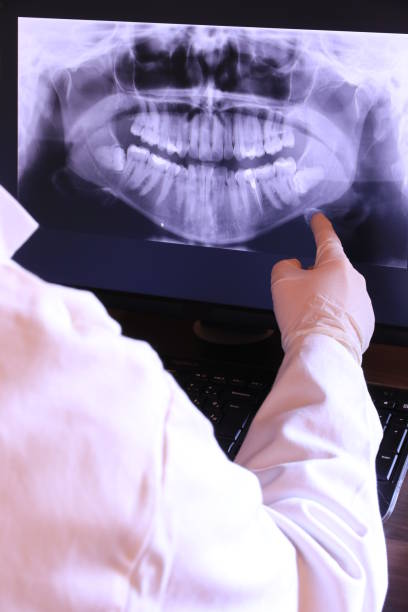 Best Emergency Treatment for Toothache in Irwin, SC