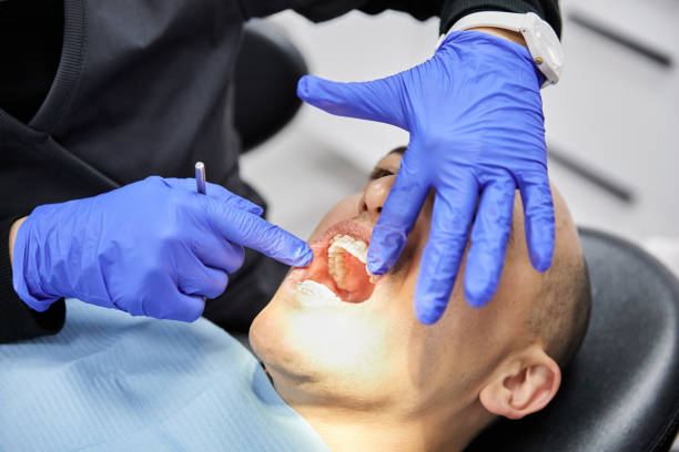 Best Emergency Tooth Extraction in Irwin, SC