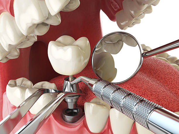Best Pediatric Emergency Dentist in Irwin, SC